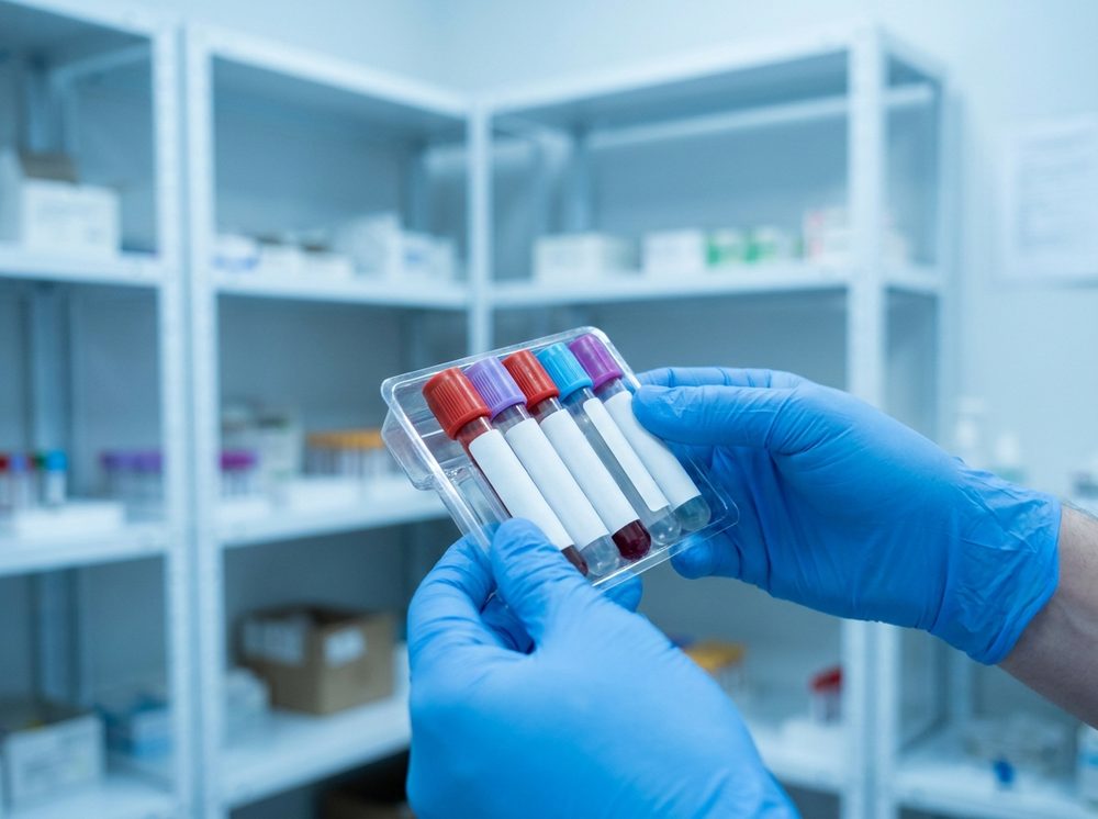 Blood sample tubes ready for on-site lab testing